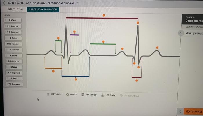 Identify components of ecg mcgraw hill