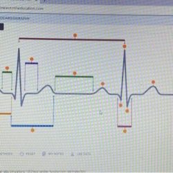 Identify components of ecg mcgraw hill