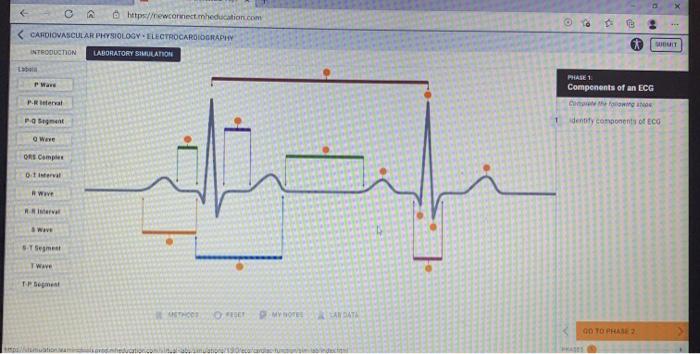 Identify components of ecg mcgraw hill