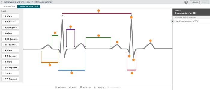 Identify components of ecg mcgraw hill