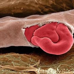 Capillary puncture blood most closely resembles