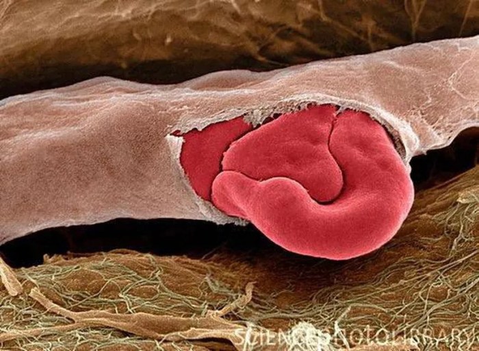 Capillary puncture blood most closely resembles