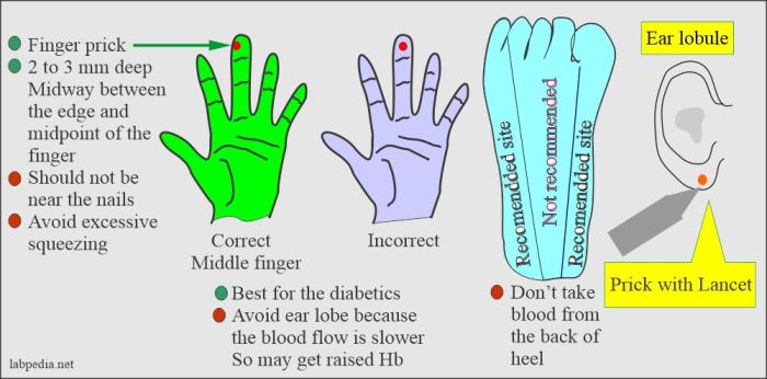 Puncture capillary