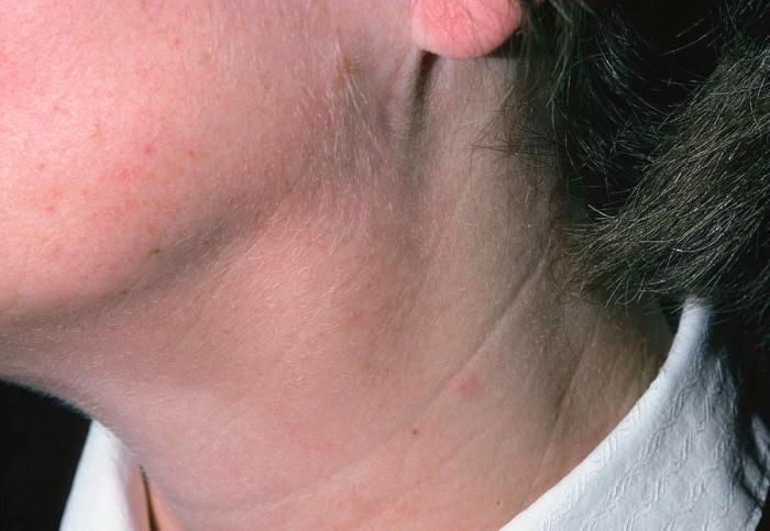 Feeling for swollen lymph nodes is an example of auscultation